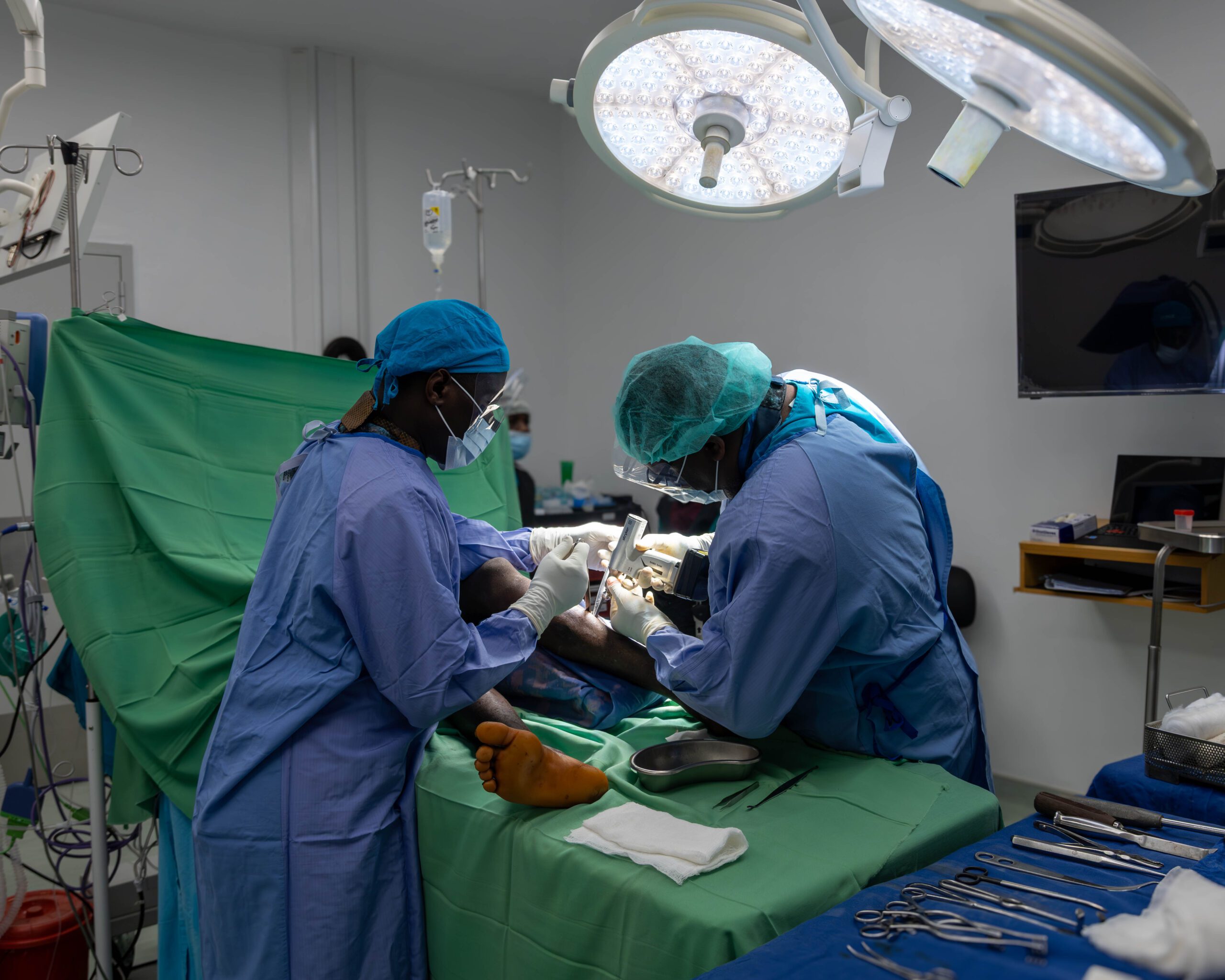 CURE Malawi's Dr Maina operating on a patient with knock knees